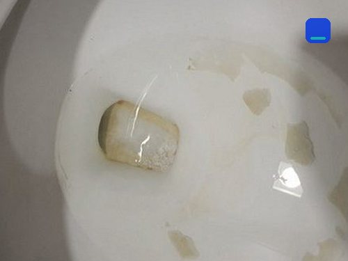 대전 동구 · 전화 상담 뒤 방문 고객 글 사진